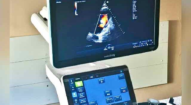 Брянский кардиодиспансер оснастили новым УЗ-аппаратом экспертного класса